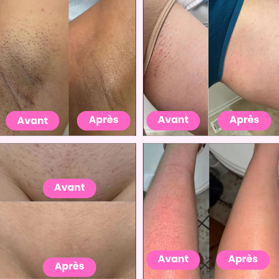 Lady Shaver • Rasoir Électrique Féminin — Peau Lisse en 30 Secondes